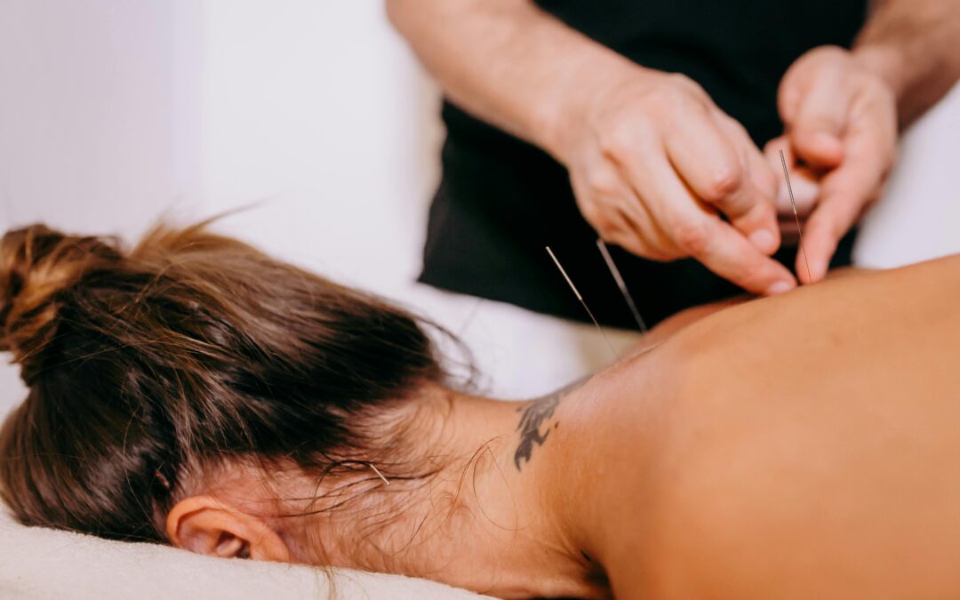 A girl receiving a massage, symbolizing athletic recovery and performance enhancement with acupuncture